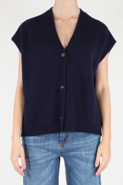Oversized Vest with Buttons